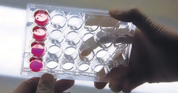Innovative CAR T-cell therapy shows promise for patients with B-cell lymphoma