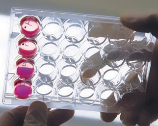 Innovative CAR T-cell therapy shows promise for patients with B-cell lymphoma