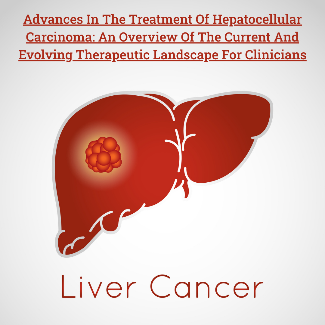 Advances In The Treatment Of Hepatocellular Carcinoma: An Overview Of The Current And Evolving Therapeutic Landscape For Clinicians