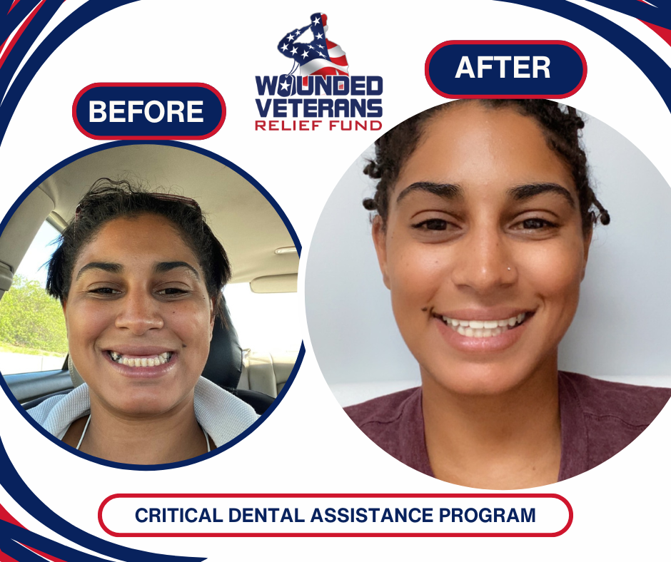 Shenita W. Before and After Dental Template