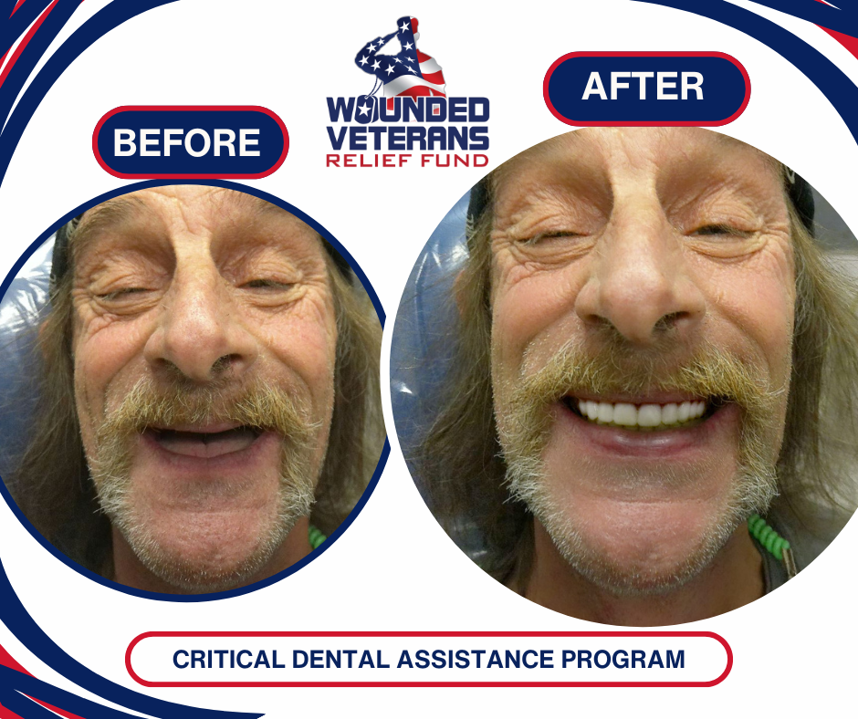 Vandergrift, Army, Before and After