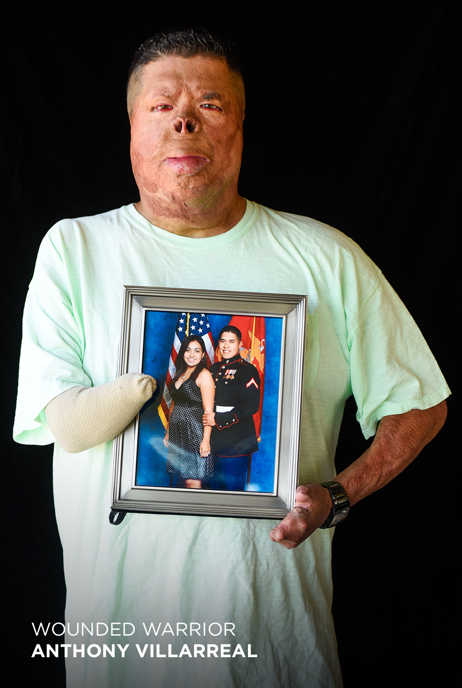 Photo of a Wounded Warrior