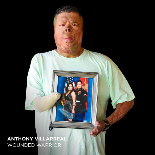 Anthony Villarreal, Wounded Warrior
